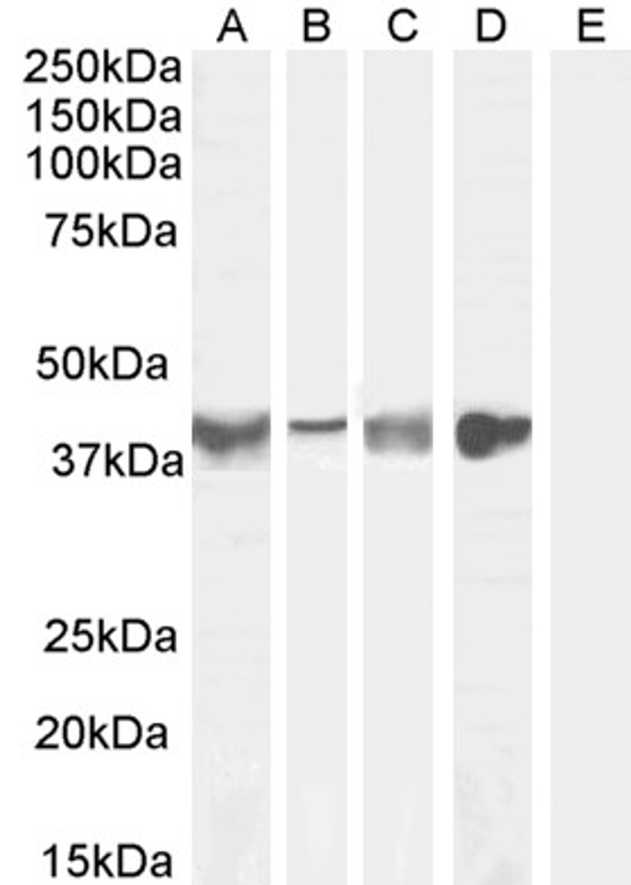 45-869 (1ug/ml) staining of Human Heart lysate (35ug protein in RIPA buffer) . Primary incubation was 1 hour. Detected by chemiluminescence.