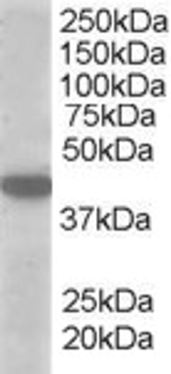 45-873 (1ug/ml) staining of A549 lysate (35ug protein in RIPA buffer) . Primary incubation was 1 hour. Detected by chemiluminescence.