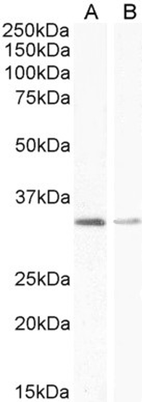 HEK293 overexpressing MDM2 and probed with 45-878 (mock transfection in first lane) .