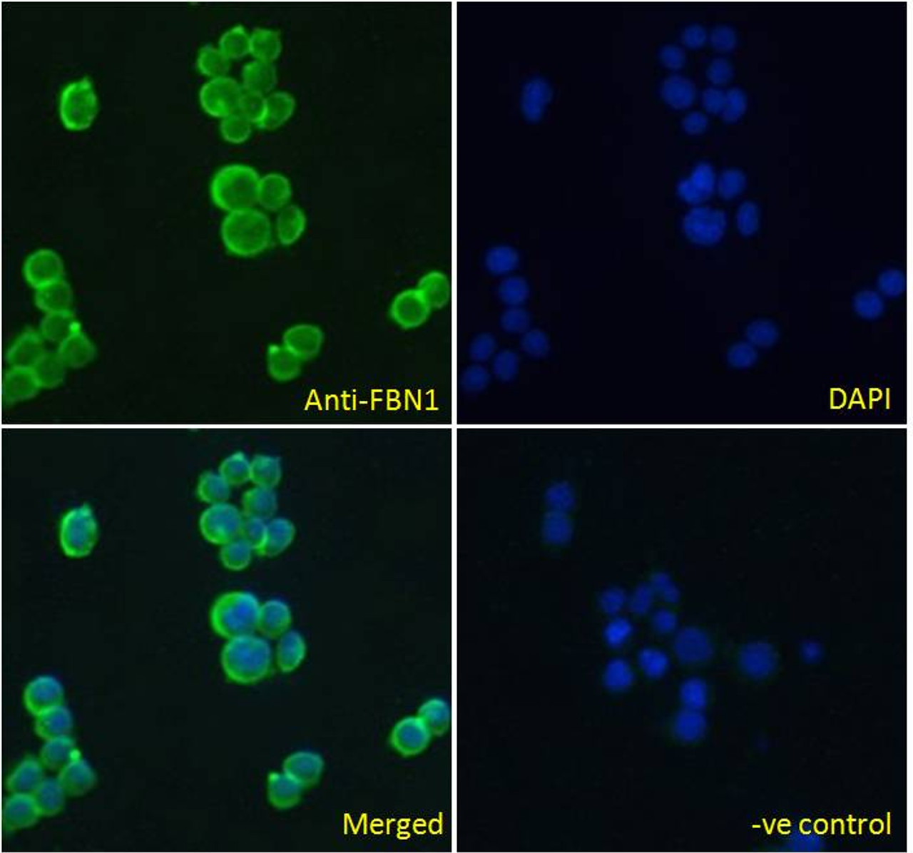42-230 Immunofluorescence analysis of paraformaldehyde fixed A431 cells, permeabilized with 0.15% Triton. Primary incubation 1hr (10ug/ml) followed by Alexa Fluor 488 secondary antibody (2ug/ml) , showing cell junction staining. The nuclear stain is DAPI