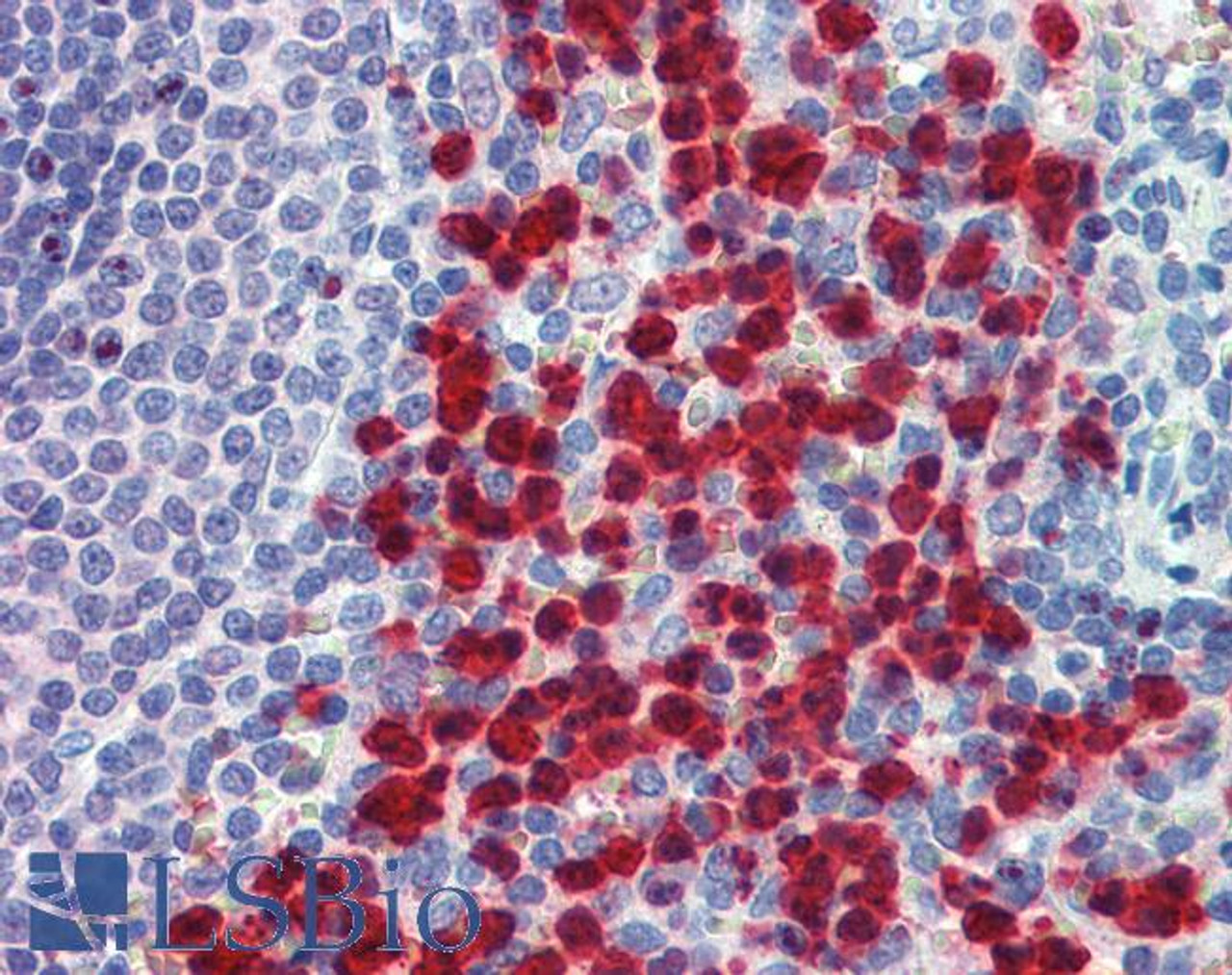 45-883 (5ug/ml) staining of paraffin embedded Human Testis. Steamed antigen retrieval with citrate buffer pH 6, AP-staining.