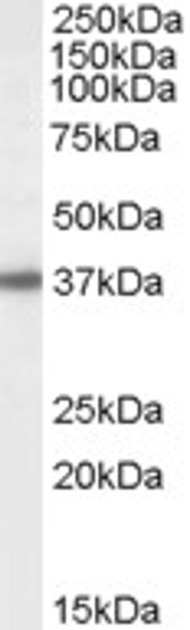 45-886 (1ug/ml) staining of Human Breast lysate (35ug protein in RIPA buffer) . Primary incubation was 1 hour. Detected by chemiluminescence.