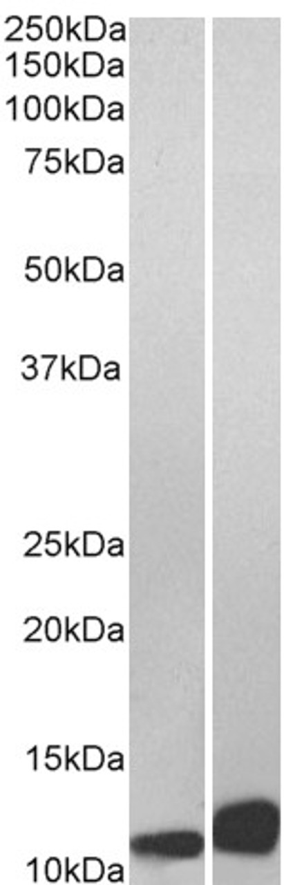 45-888 (1.5ug/ml) as the reporter antibody.