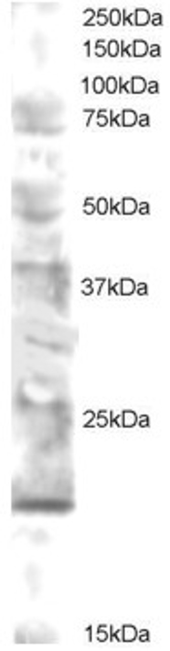 45-892 staining (0.5ug/ml) of human brain lysate (RIPA buffer, 30ug total protein per lane) . Primary incubated for 12 hour. Detected by western blot using chemiluminescence.