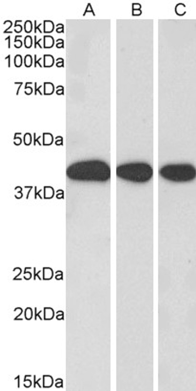 45-901 (0.3ug/ml) staining of Mouse Liver (A) , Rat Liver (B) and Pig Liver (C) lysate (35ug protein in RIPA buffer) . Primary incubation was 1 hour. Detected by chemiluminescence