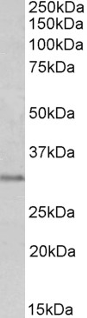 45-909 (0.3ug/ml) staining of Human Prostate lysate (35ug protein in RIPA buffer) . Primary incubation was 1 hour. Detected by chemiluminescence.