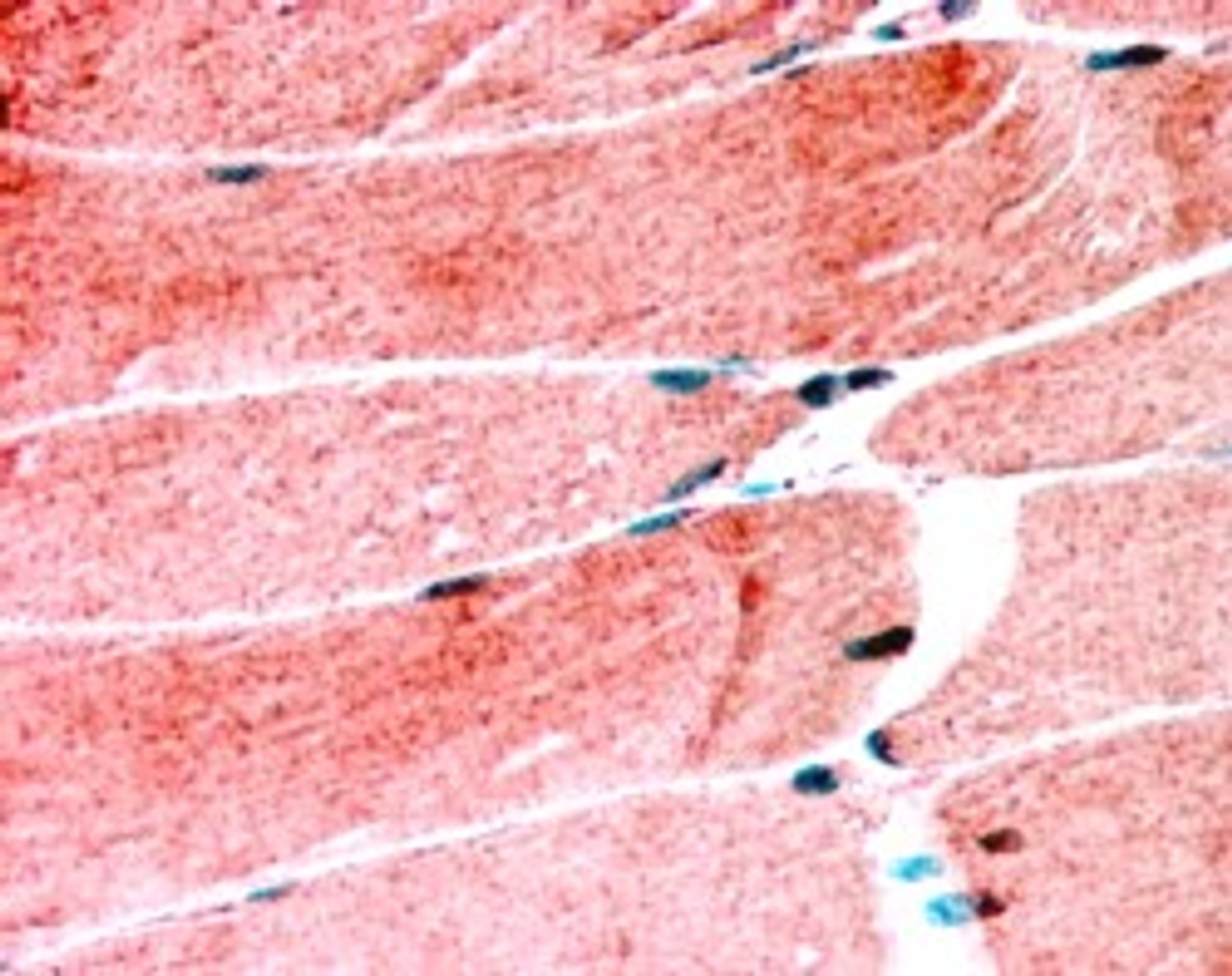 45-917 (1.25ug/ml) staining of paraffin embedded Human Skeletal Muscle. Steamed antigen retrieval with citrate buffer pH 6, AP-staining.