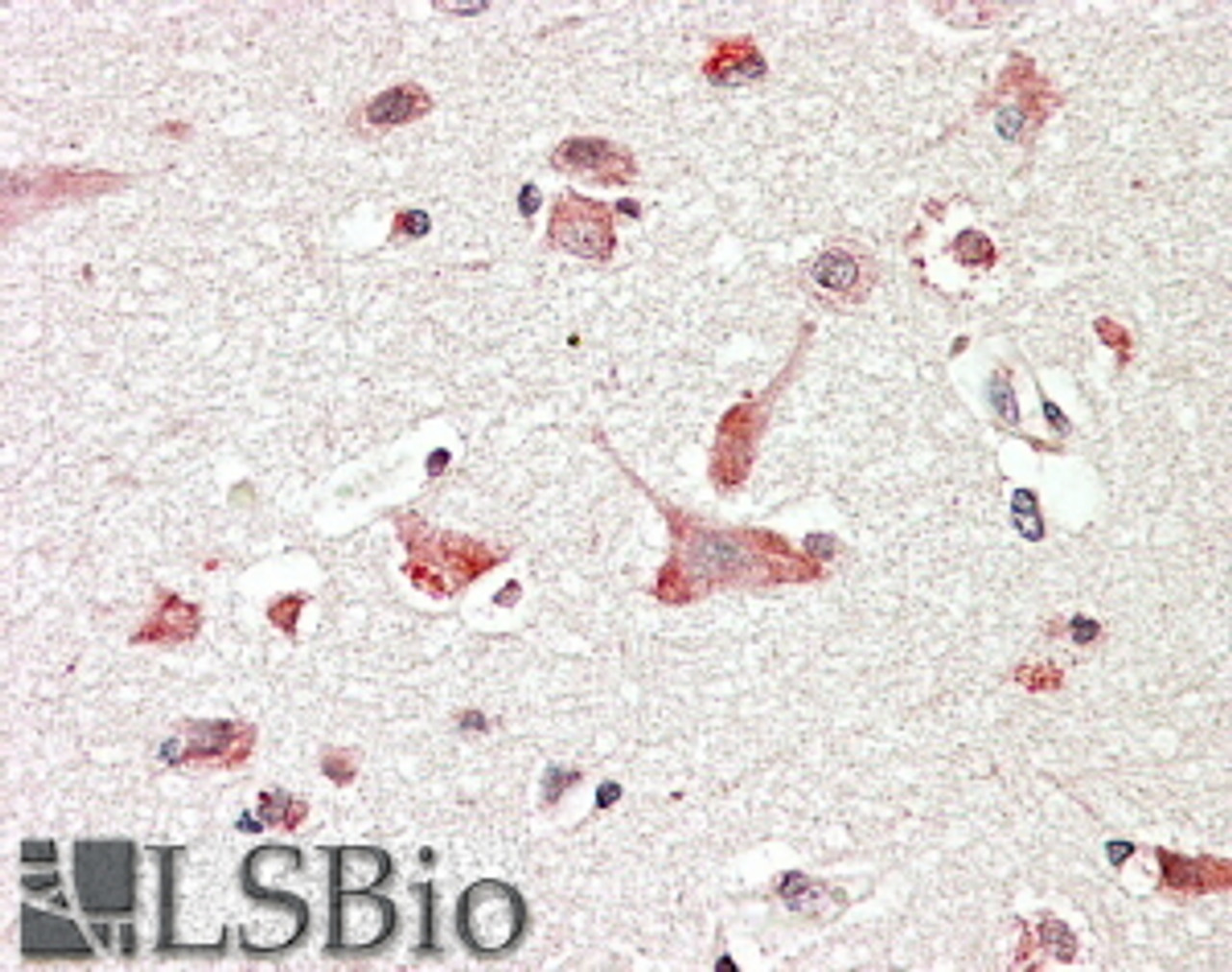 45-918 (1.25ug/ml) staining of paraffin embedded Human Skeletal Muscle. Steamed antigen retrieval with citrate buffer pH 6, AP-staining.