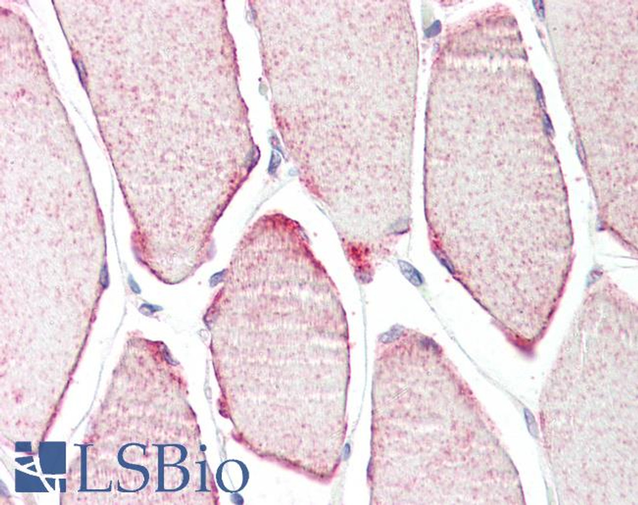 45-920 (3.75ug/ml) staining of paraffin embedded Human Skeletal Muscle. Steamed antigen retrieval with citrate buffer pH 6, AP-staining.