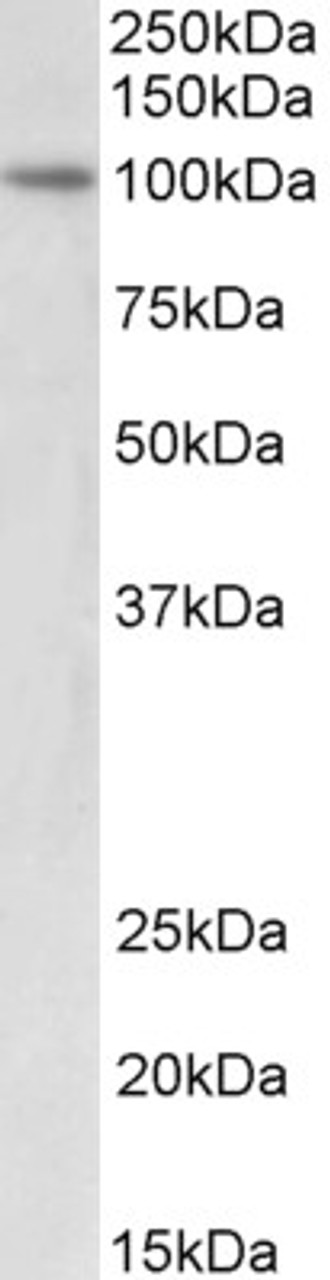 45-923 (0.1ug/ml) staining of rat stomach lysate (35ug protein in RIPA buffer) . Primary incubation was 1 hour. Detected by chemiluminescence.