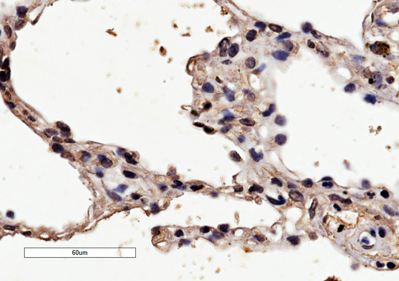 45-930 (0.5ug/ml) staining of Human Bone Marrow lysate (35ug protein in RIPA buffer) . Primary incubation was 1 hour. Detected by chemiluminescence.