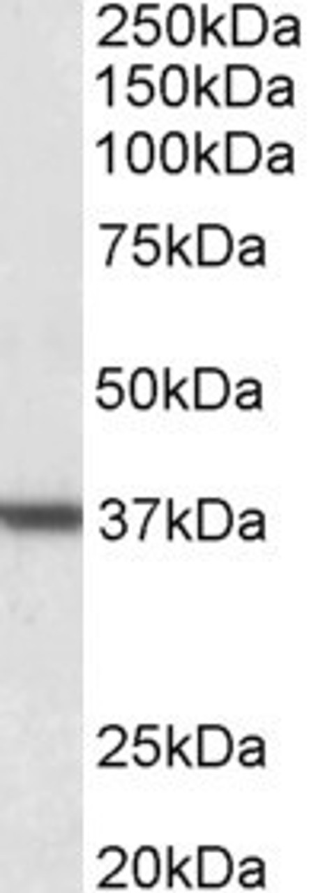 45-932 (5ug/ml) as the reporter antibody.