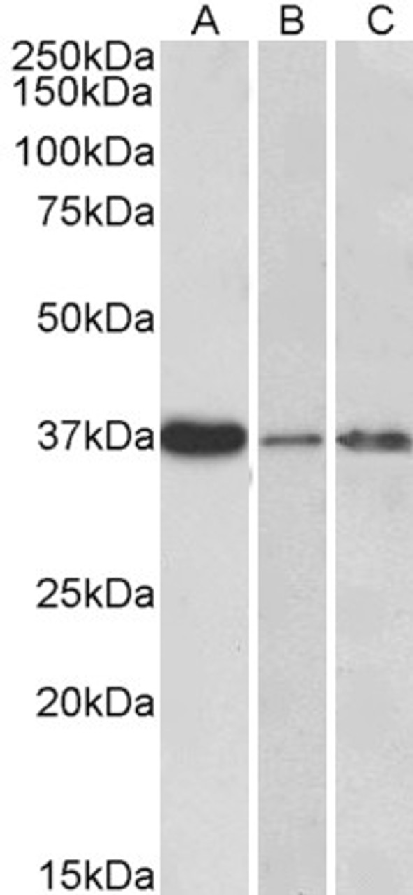 HEK293 overexpressing P40PHOX and probed with 45-937 (mock transfection in first lane) .
