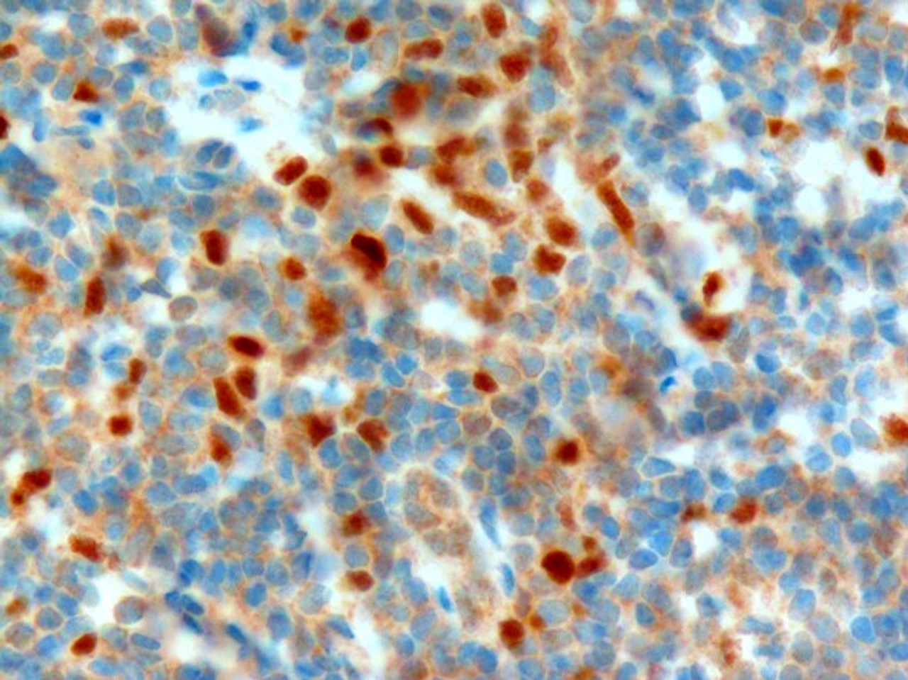 45-947 (1ug/ml) staining of paraffin embedded Human Tonsil. Microwaved antigen retrieval with citrate buffer pH 6, HRP-staining.