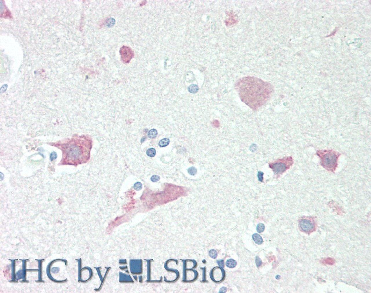 45-961 (1ug/ml) staining of Human Brain lysate (35ug protein in RIPA buffer) . Detected by chemiluminescence.