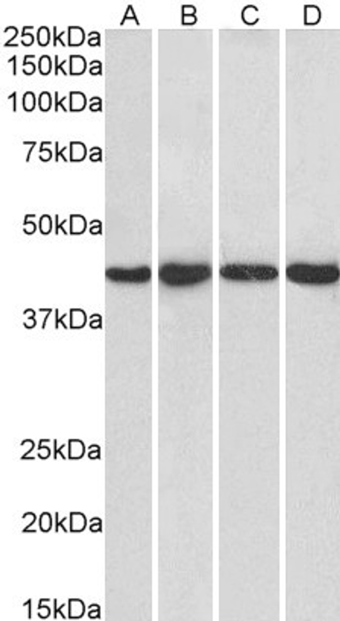 45-968 (1ug/ml) staining of HeLa (A) , HepG2 (B) , Jurkat (C) and NIH3T3 (D) nuclear lysate (35ug protein in RIPA buffer) . Detected by chemiluminescence.