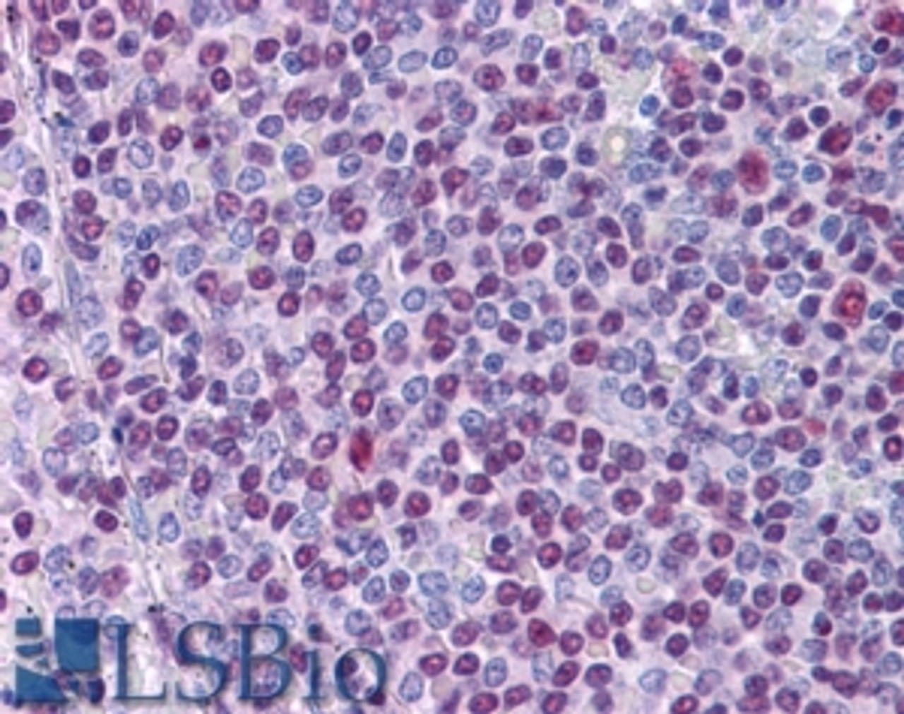 45-976 (0.1ug/ml) staining of Mouse Brain lysate (35ug protein in RIPA buffer) . Primary incubation was 1 hour. Detected by chemiluminescence.