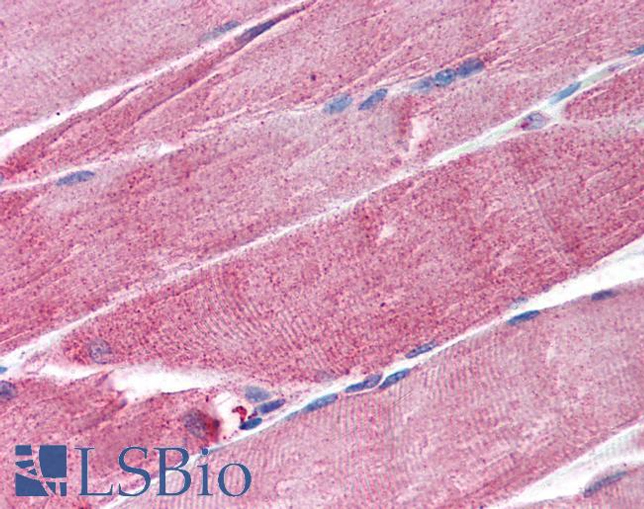 45-978 (5ug/ml) staining of paraffin embedded Human Placenta. Steamed antigen retrieval with citrate buffer Ph 6, AP-staining.