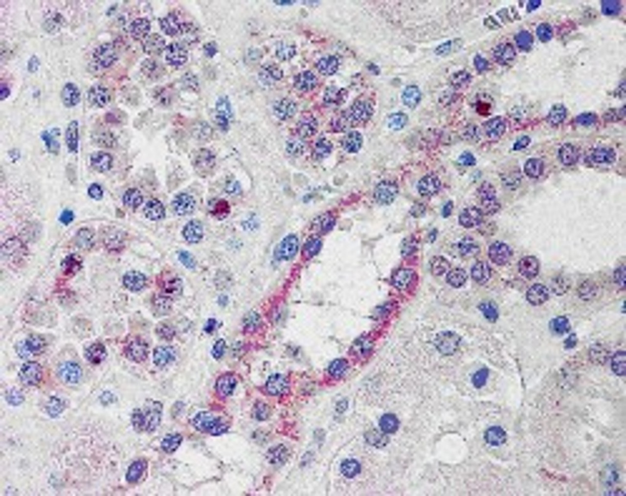 45-979 (10ug/ml) staining of paraffin embedded Human Kidney. Steamed antigen retrieval with citrate buffer pH 6, AP-staining.