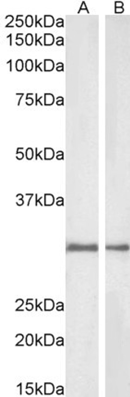 45-981 (1ug/ml) staining of Rat (A) and Pig (B) Kidney lysate (35ug protein in RIPA buffer) . Detected by chemiluminescence