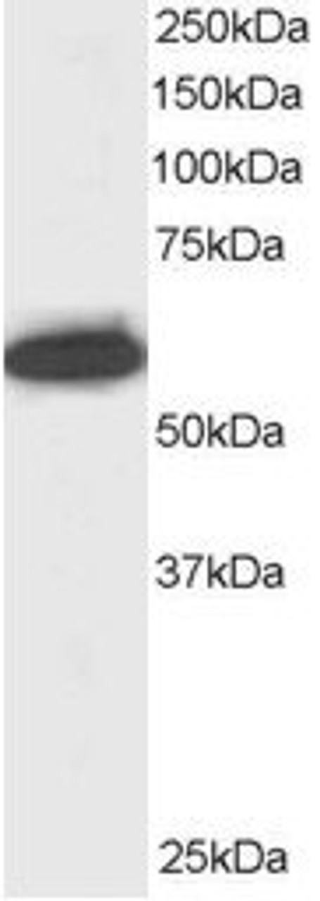 45-985 staining (0.5ug/ml) of Jurkat lysate (RIPA buffer, 30ug total protein per lane) . Primary incubated for 1 hour. Detected by western blot using chemiluminescence.
