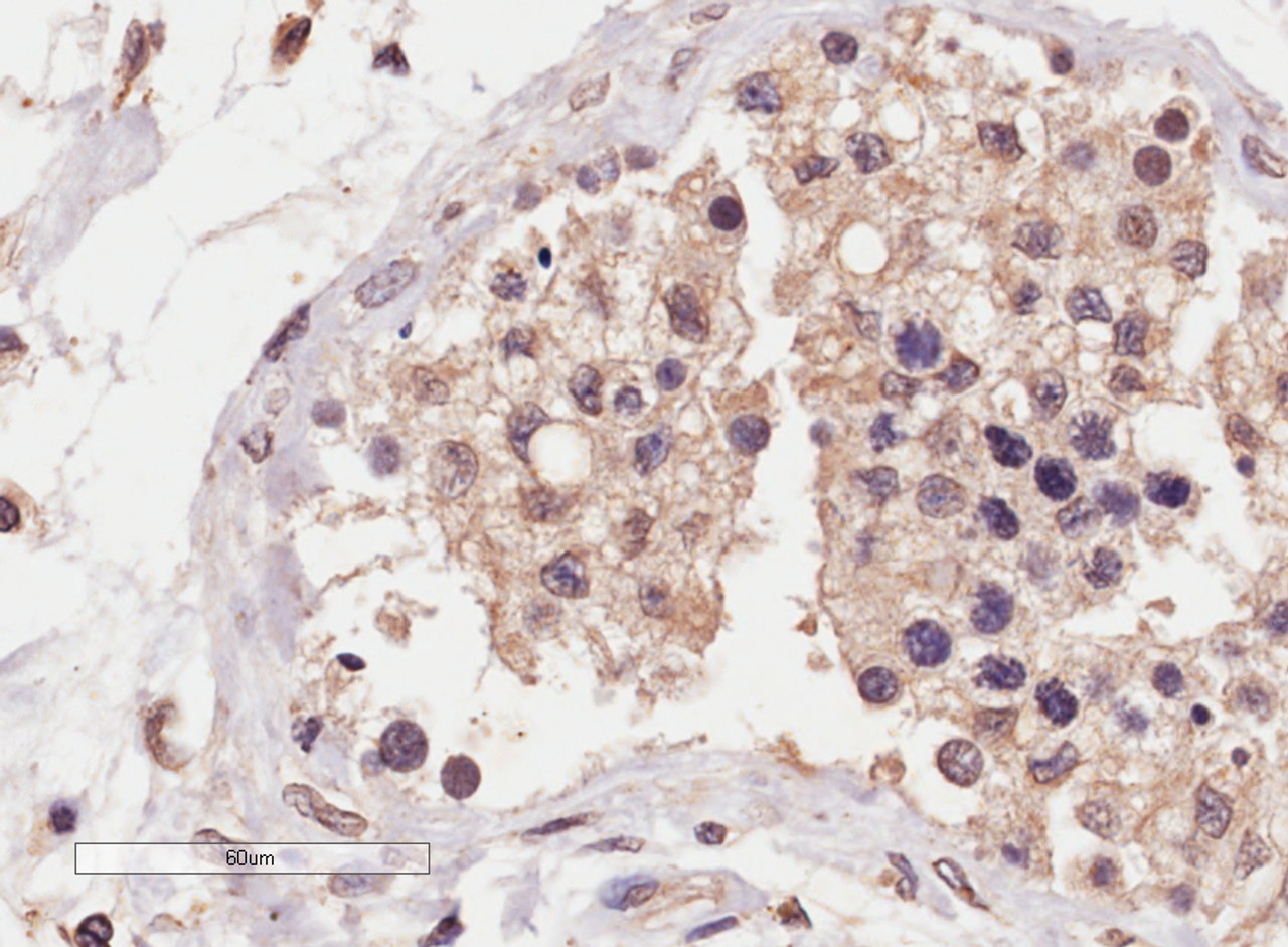 45-988 (5ug/ml) staining of paraffin embedded Human Breast. Steamed antigen retrieval with citrate buffer pH 6, AP-staining.