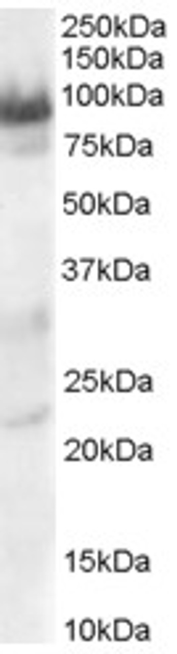 45-996 staining (0.3ug/ml) of Human Heart lysate (RIPA buffer, 30ug total protein per lane) . Primary incubated for 1 hour. Detected by chemiluminescence.