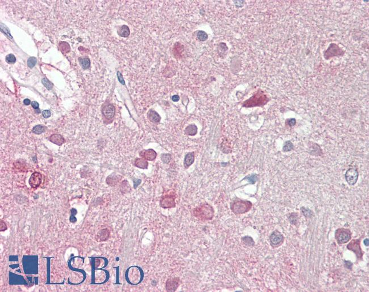 46-101 (3.75ug/ml) staining of paraffin embedded Human Cortex. Steamed antigen retrieval with citrate buffer pH 6, AP-staining.