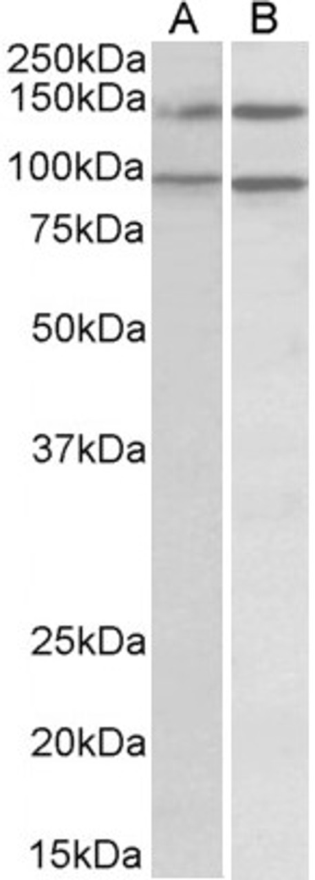 46-122 (0.5ug/ml) staining of lysates of cell lines Daudi (A) and Caco-2 (B) (35ug protein in RIPA buffer) . Primary incubation was 1 hour. Detected by chemiluminescence.