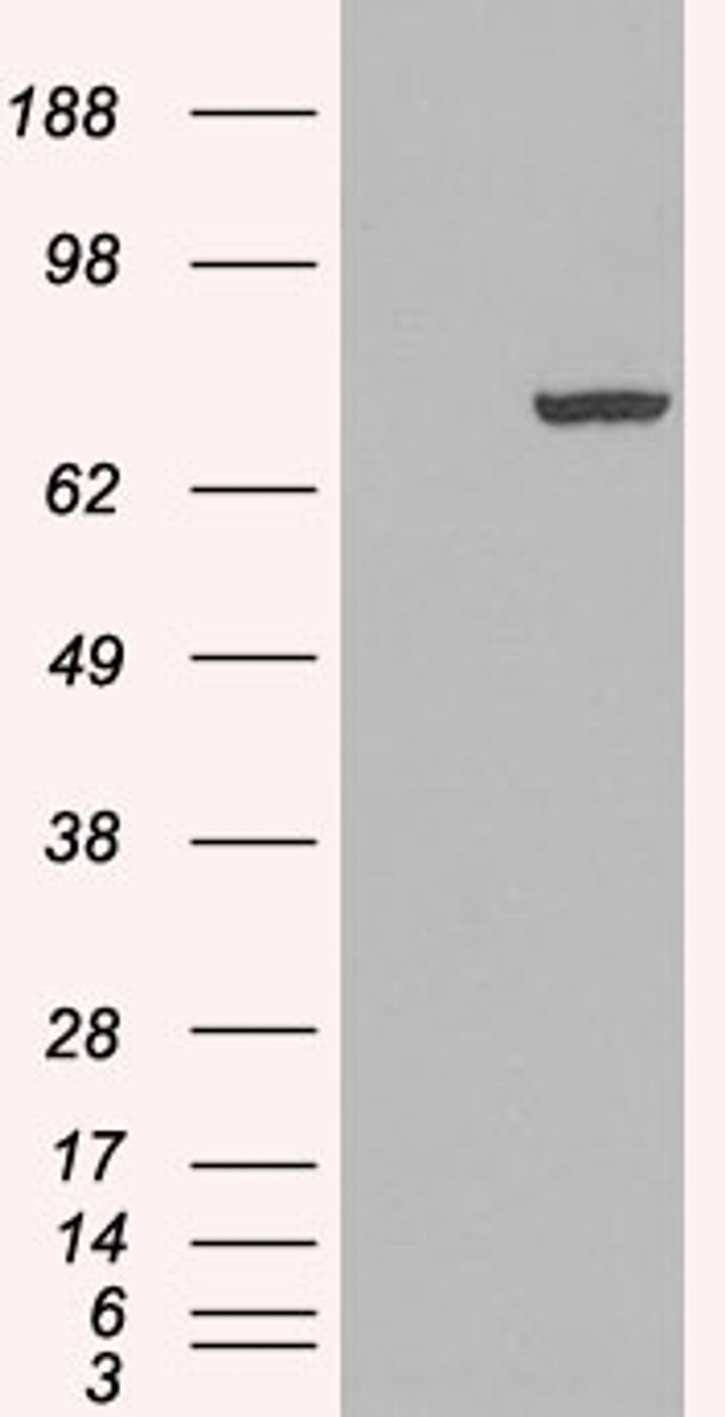 HEK293 overexpressing PADI4 and probed with 46-126 (mock transfection in first lane) .