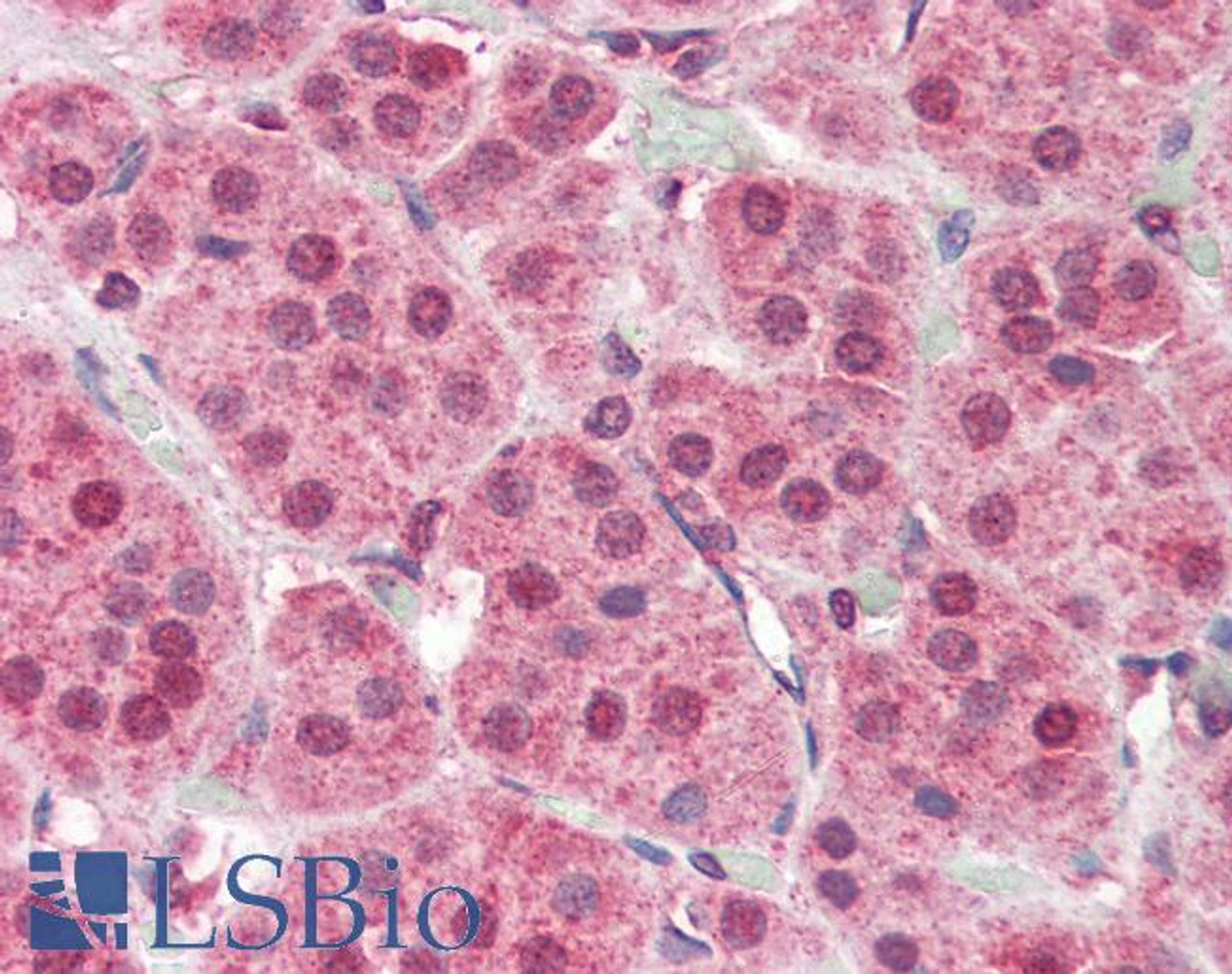 46-134 (5ug/ml) staining of paraffin embedded Human Skin. Steamed antigen retrieval with citrate buffer pH 6, AP-staining.