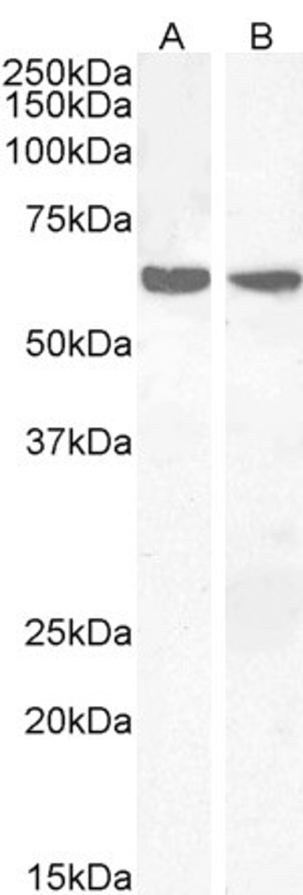 46-147 (0.3ug/ml) staining of Human Adipose lysate (35ug protein in RIPA buffer) . Detected by chemiluminescence.