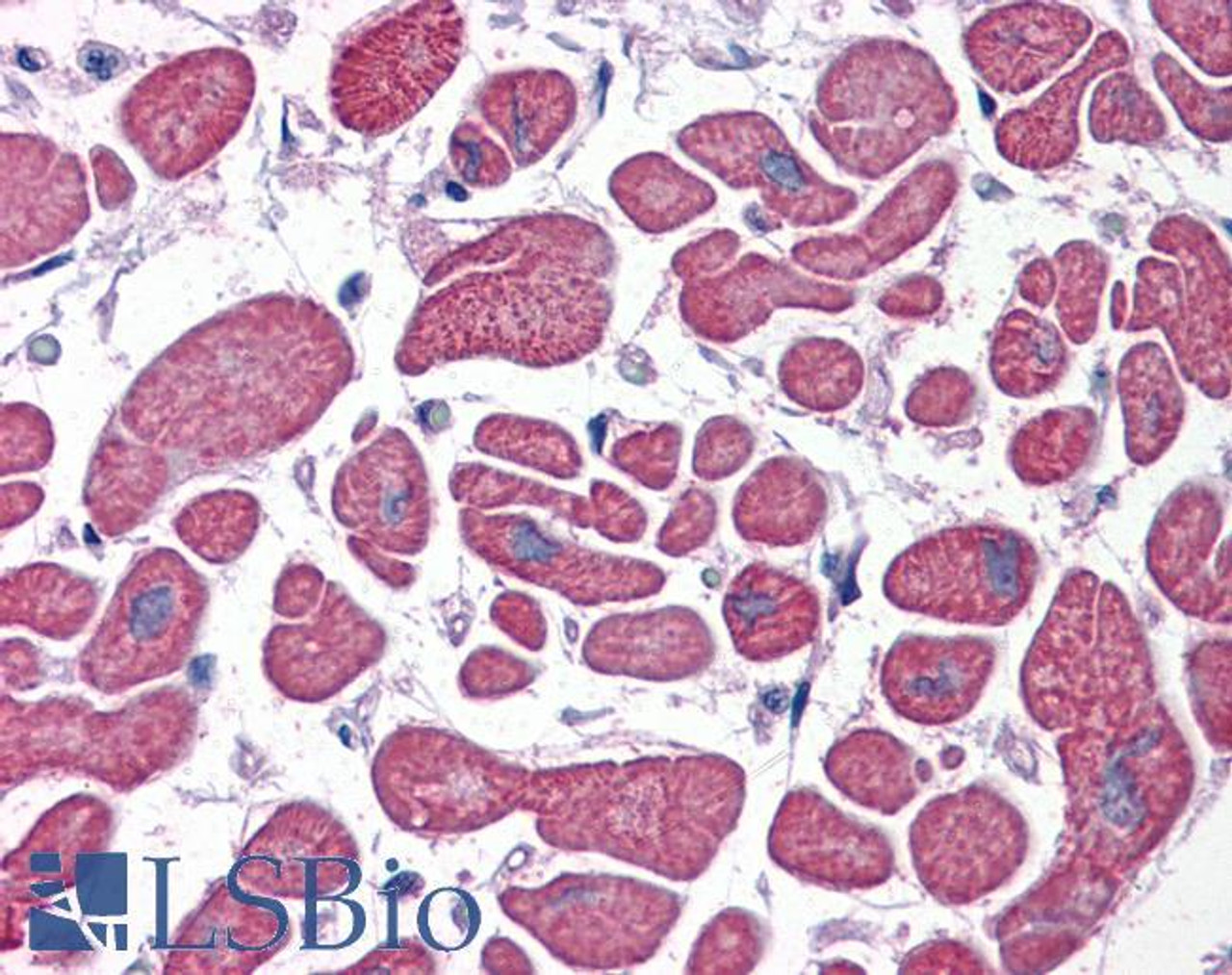 46-151 (5ug/ml) staining of paraffin embedded Human Skeletal Muscle. Steamed antigen retrieval with citrate buffer pH 6, AP-staining.