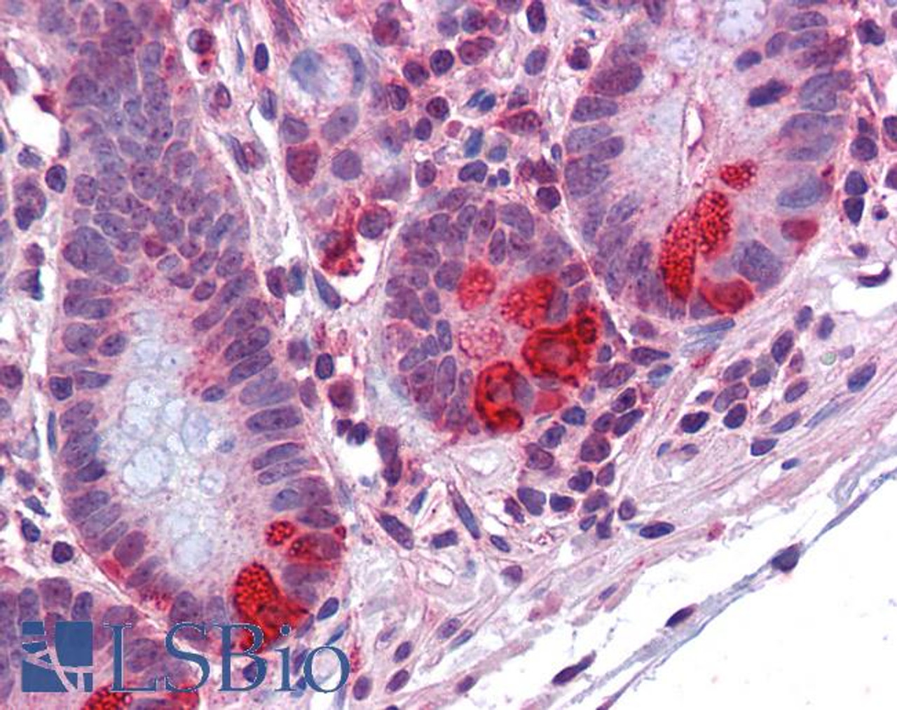 46-167 (2ug/ml) staining of paraffin embedded Human Colon. Steamed antigen retrieval with citrate buffer pH 6, AP-staining.