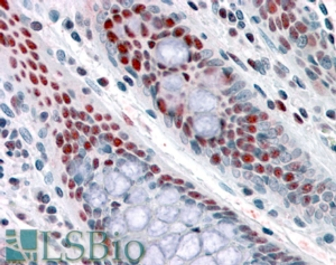 46-168 staining of differentiated 3T3-L1 adipocytes. Data kindly provided by Prof. J. Granneman, Detroit, USA. <strong>This data is from a previous batch, not on sale.</strong>