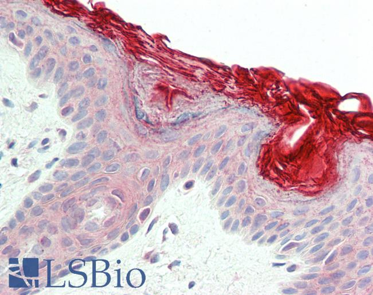 46-169 (1ug/ml) staining of Human Liver lysate (35ug protein in RIPA buffer) . Primary incubation was 1 hour. Detected by chemiluminescence.