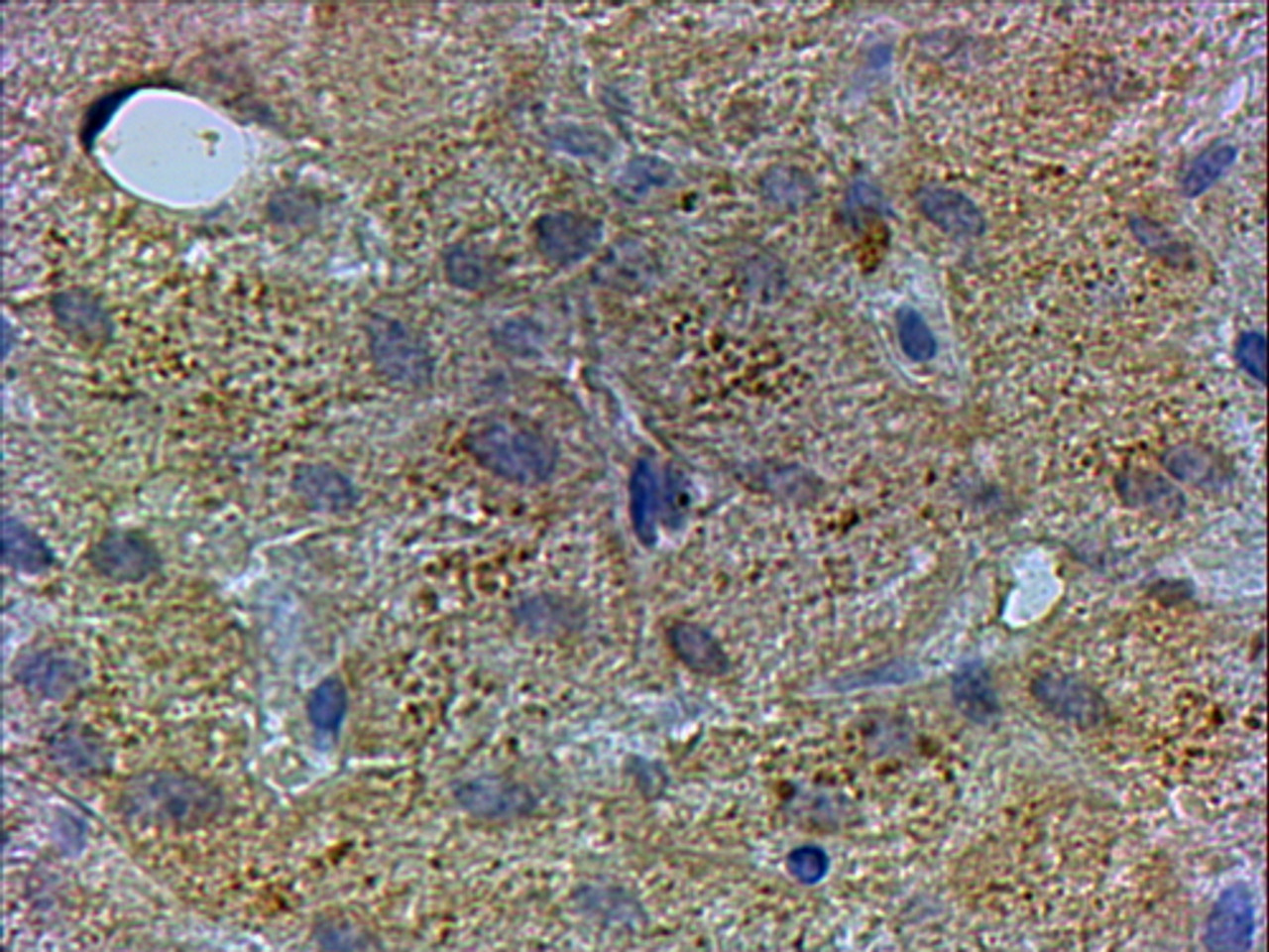 46-170 (xug/ml) staining of paraffin embedded Human Liver. Steamed antigen retrieval with citrate buffer pH 6, HRP-staining.