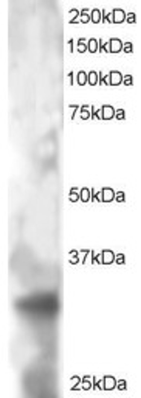 46-176 staining (2ug/ml) of HeLa lysate (RIPA buffer, 30ug total protein per lane) . Primary incubated for 1 hour. Detected by western blot using chemiluminescence.