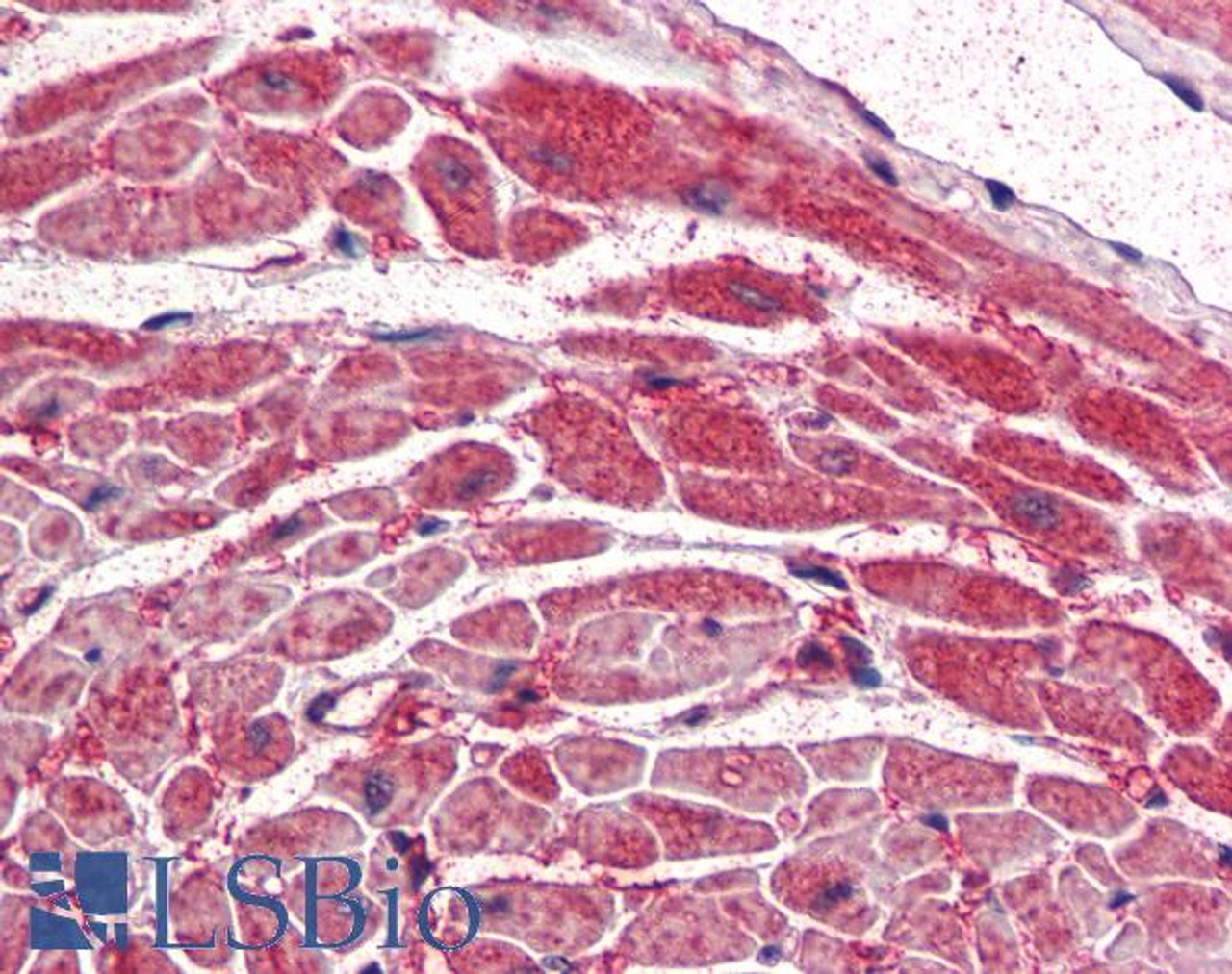 46-186 (2.5ug/ml) staining of paraffin embedded Human Brain (Cerebellar Cortex) . Steamed antigen retrieval with citrate buffer pH 6, AP-staining.