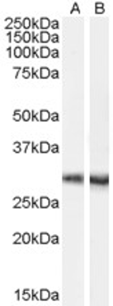 46-189 (0.2ug/ml) staining of Rat Brain lysate (35ug protein in RIPA buffer) . Primary incubation was 1 hour. Detected by chemiluminescence.