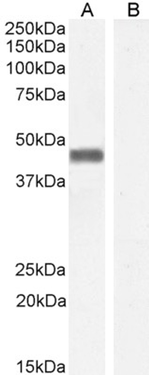 46-201 staining (0.01ug/ml) of Human Parathyroid lysate (A) and negative control HepG2 (B) cell lysate (35ug protein in RIPA buffer) . . Detected by chemiluminescence.