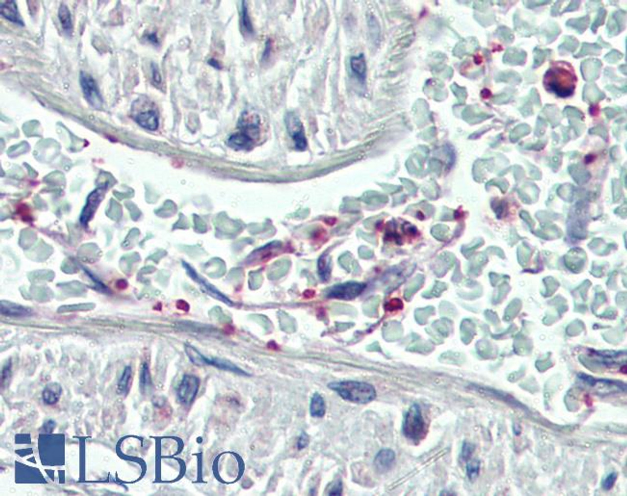 46-201 (3.75ug/ml) staining of paraffin embedded Human Vessel (platelets) . Steamed antigen retrieval with citrate buffer Ph 6, AP-staining.