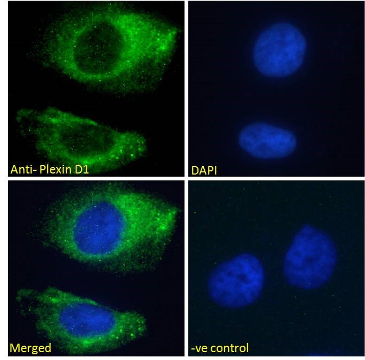 46-202 Immunofluorescence analysis of paraformaldehyde fixed HeLa cells, permeabilized with 0.15% Triton. Primary incubation 1hr (10ug/ml) followed by Alexa Fluor 488 secondary antibody (2ug/ml) , showing membrane/cytoplasmic staining. The nuclear stain i