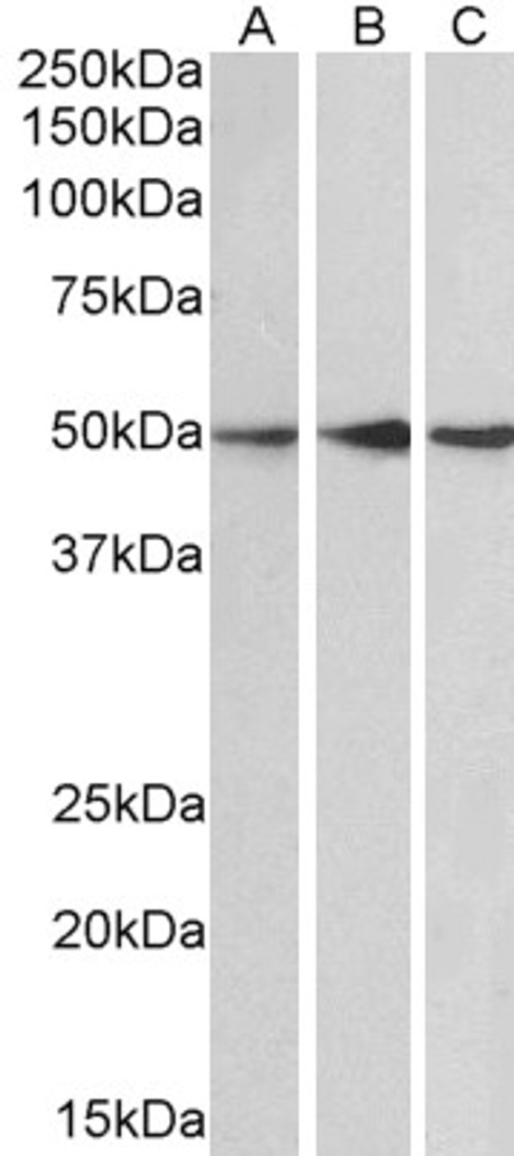 46-212 (0.1ug/ml) staining of Human Cerebellum (A) , Mouse (B) and Rat (C) Brain lysate (35ug protein in RIPA buffer) . Primary incubation was 1 hour. Detected by chemiluminescence.