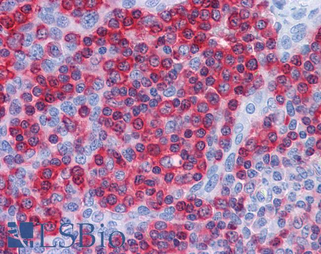 46-228 (3.75ug/ml) staining of paraffin embedded Human Kidney. Steamed antigen retrieval with citrate buffer pH 6, AP-staining.