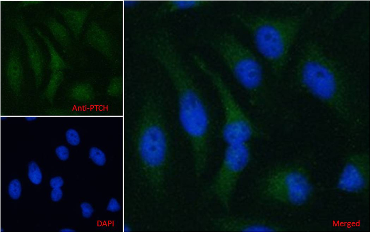 46-245 (3.75ug/ml) staining of paraffin embedded Human Breast. Steamed antigen retrieval with citrate buffer pH 6, AP-staining.