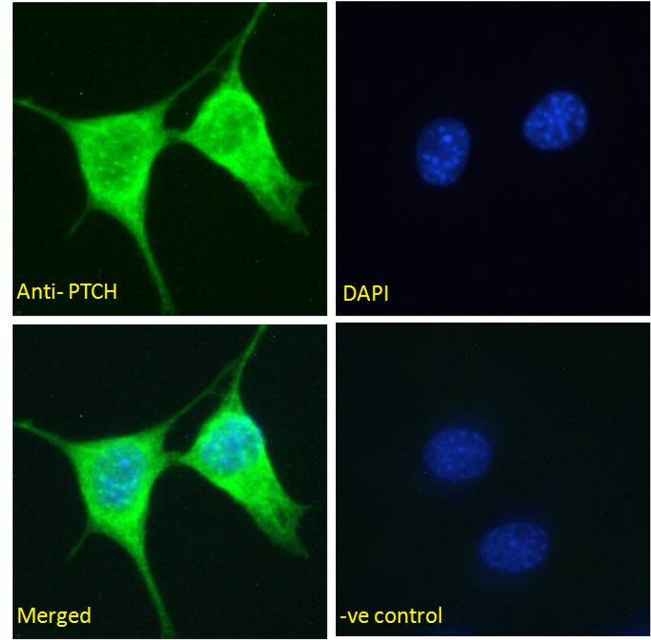 46-245 Immunofluorescence analysis of paraformaldehyde fixed HeLa cells, permeabilized with 0.15% Triton. Primary incubation 1hr (5ug/ml) followed by Alexa Fluor 488 secondary antibody (1ug/ml) , showing cytoplasmic staining. The nuclear stain is DAPI (bl