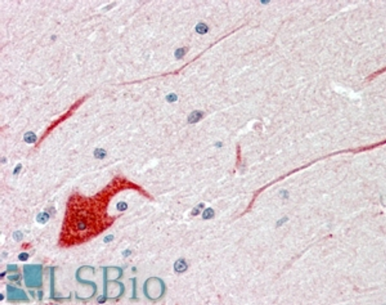 46-250 (3.75ug/ml) staining of paraffin embedded Human Cerebellum. Steamed antigen retrieval with citrate buffer pH 6, AP-staining. <strong>This data is from a previous batch, not on sale.</strong>