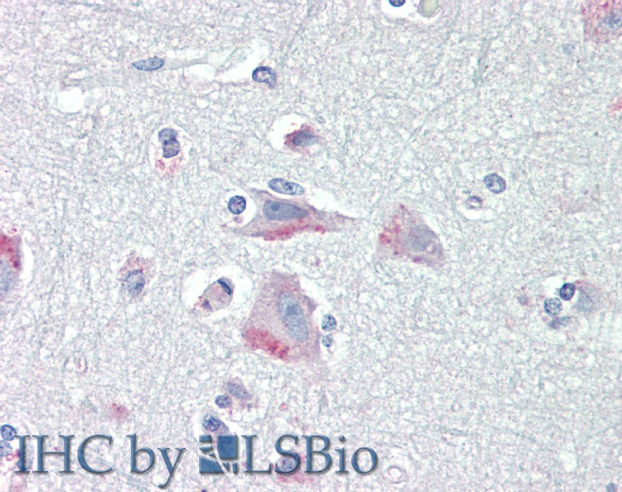 46-263 (5ug/ml) as the reporter antibody.