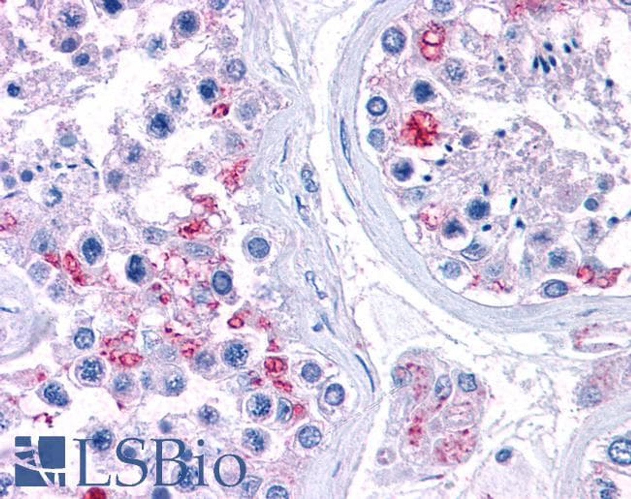 46-296 (3.75ug/ml) staining of paraffin embedded Human Thyroid. Steamed antigen retrieval with citrate buffer pH 6, AP-staining.